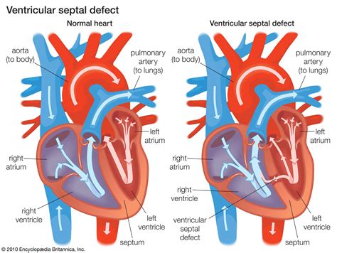 what is the function and anatomy of left ventricle